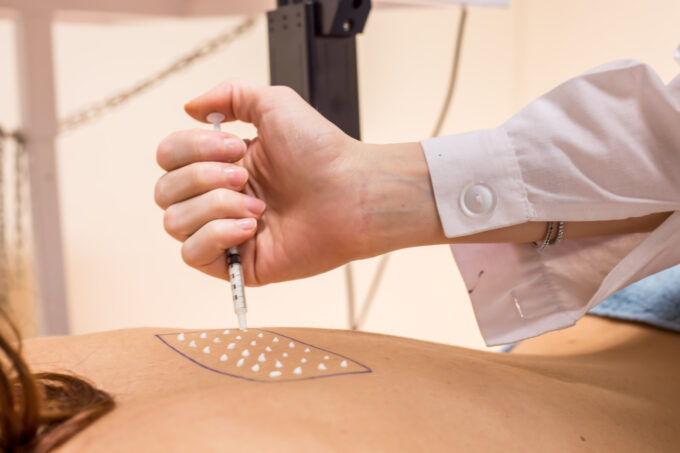 Image of a woman lying on her back while a sunscreen test is applied, symbol of the blog article dedicated to clinical tests in makeup: a competitive advantage because they are fundamental for beauty brands, of the cosmetic & medical device business unit of Abich_Lifeanalytics